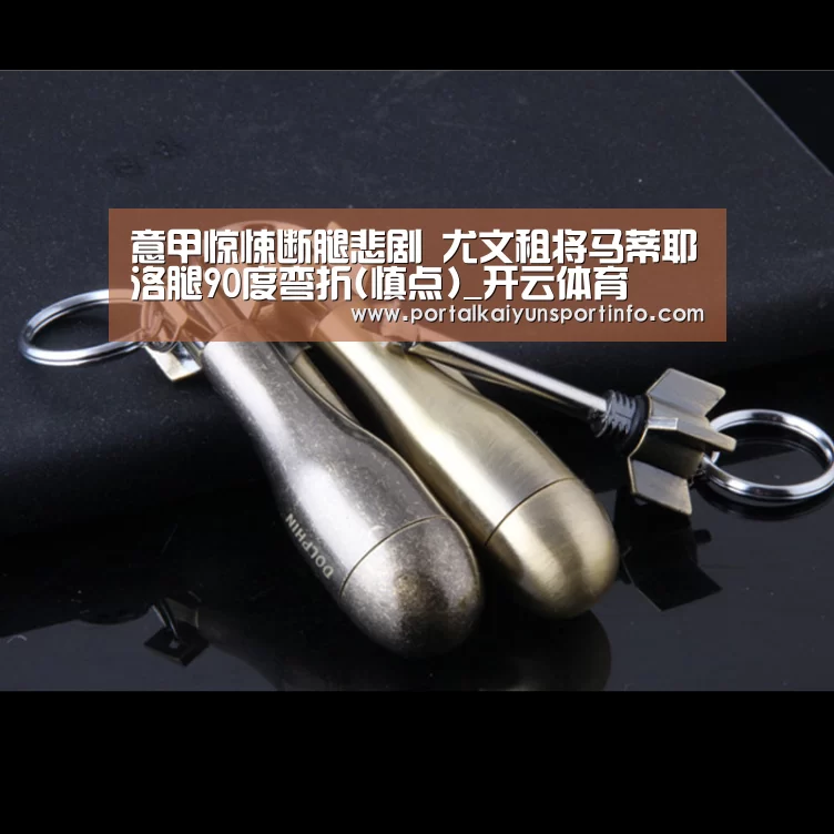 意甲惊悚断腿悲剧 尤文租将马蒂耶洛腿90度弯折(慎点)_开云体育(图3) 意甲惊悚断腿悲剧 尤文租将马蒂耶洛腿90度弯折(慎点)_开云体育(图3)